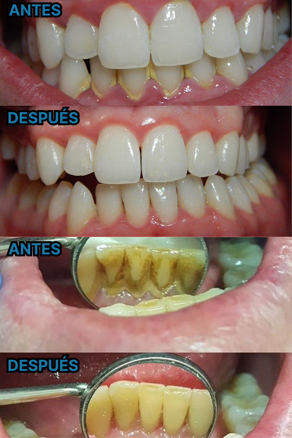 HYDRO PULSE - DUCHA DENTAL + EBOOK DE REGALO ( COMO ELIMINAR EL MAL ALIENTO EN 7 SIMPLES PASOS )