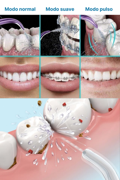 HYDRO PULSE - DUCHA DENTAL + EBOOK DE REGALO ( COMO ELIMINAR EL MAL ALIENTO EN 7 SIMPLES PASOS )