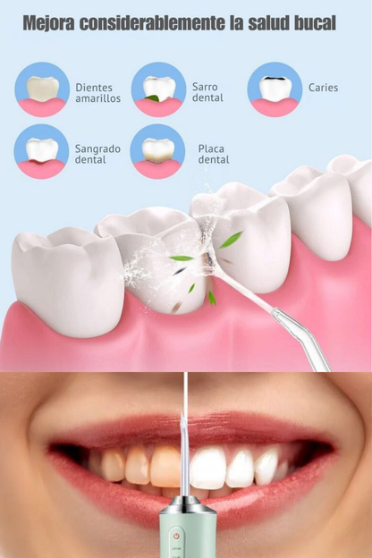 HYDRO PULSE - DUCHA DENTAL + EBOOK DE REGALO ( COMO ELIMINAR EL MAL ALIENTO EN 7 SIMPLES PASOS )